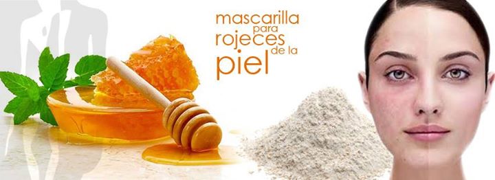 Rojeces en la piel